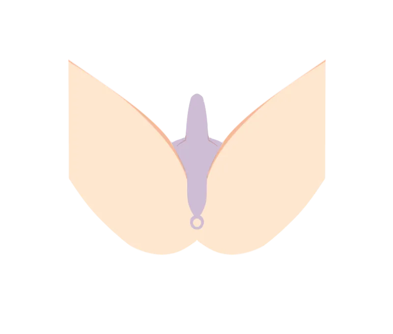 イラスト：ハイジニーナ（VIO）